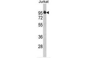 Western blot analysis of HTATSF1 Antibody (N-term) in Jurkat cell line lysates (35ug/lane). (HTATSF1 Antikörper  (N-Term))