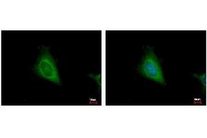 ICC/IF Image HSD17B4 antibody detects HSD17B4 protein at cytoplasm by immunofluorescent analysis.