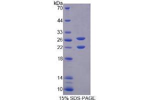 SDS-PAGE analysis of Mouse AVPI1 Protein. (AVPI1 Protein)