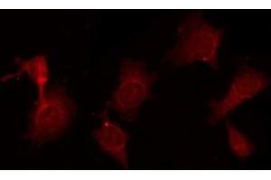 Immunofluorescence (fixed cells) (IF/ICC) image for anti-Transforming Growth Factor, beta 1 (TGFB1) (C-Term) antibody (ABIN6266431)