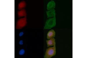 ABIN6257878 and ABIN6275516 staining Hela cells by IF/ICC. (SERGEF Antikörper  (Internal Region))