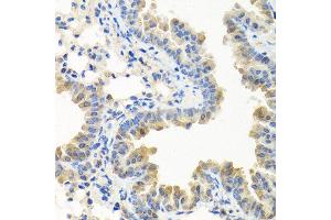 Immunohistochemistry of paraffin-embedded mouse lung using LRG1 antibody at dilution of 1:100 (40x lens).