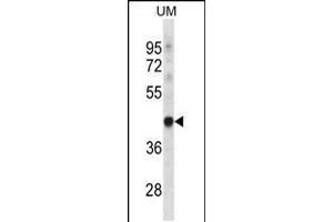 Western blot analysis in uterus tumor cell line lysates (35ug/lane). (TRUB1 Antikörper  (AA 152-180))