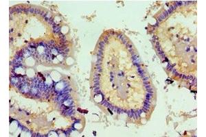 Immunohistochemistry (IHC) image for anti-Tumor Necrosis Factor (Ligand) Superfamily, Member 18 (TNFSF18) (AA 72-199) antibody (ABIN7173812)