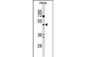 Western blot analysis in Hela cell line lysates (35ug/lane). (ALG2 Antikörper  (AA 254-282))