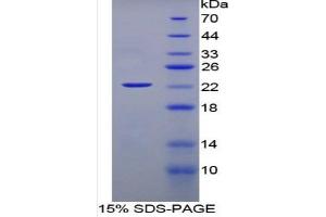 SDS-PAGE of Protein Standard from the Kit (Highly purified E. (IFNA ELISA Kit)