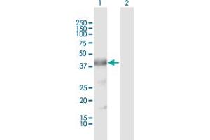 Western Blotting (WB) image for anti-Arginase, Type II (ARG2) (AA 1-354) antibody (ABIN947579)