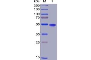 Human GITR Ligand Protein, mFc-His Tag on SDS-PAGE under reducing condition.
