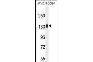 TDRD7 Antibody (C-term) (ABIN654935 and ABIN2844578) western blot analysis in mouse bladder tissue lysates (35 μg/lane).