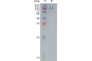 Human IL12RB1 Protein, His Tag on SDS-PAGE under reducing condition.