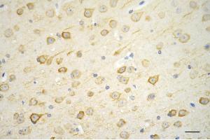 anti-Microtubule-Associated Protein 1 Light Chain 3 beta (MAP1LC3B) antibody