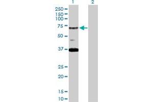 Western Blot analysis of RAD17 expression in transfected 293T cell line by RAD17 MaxPab polyclonal antibody. (RAD17 Antikörper  (AA 1-584))