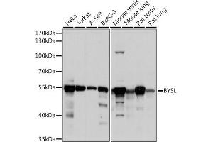 Western blot analysis of extracts of various cell lines, using BYSL antibody (ABIN6129546, ABIN6137672, ABIN6137674 and ABIN6215553) at 1:1000 dilution. (Bystin-Like Antikörper  (AA 120-280))