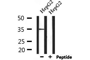 Western blot analysis of extracts from HepG2, using MSHR Antibody. (MC1 Receptor Antikörper  (C-Term))