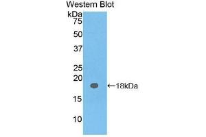 Western Blotting (WB) image for anti-Carcinoembryonic Antigen Gene Family (CEA) antibody (Biotin) (ABIN1172455) (CEA Antikörper  (Biotin))