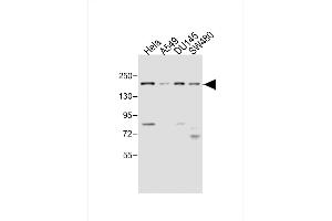 All lanes : Anti-MED14 Antibody (Center) at 1:4000 dilution Lane 1: Hela whole cell lysate Lane 2: A549 whole cell lysate Lane 3: D whole cell lysate Lane 4: S whole cell lysate Lysates/proteins at 20 μg per lane. (MED14 Antikörper  (AA 586-615))