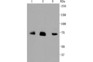 Lane 1: JAR lysates, Lane 2: HUVEC lysates, Lane 3: Hela lysates probed with Alas1 (1G11) Monoclonal Antibody  at 1:1000. (ALAS1 Antikörper)