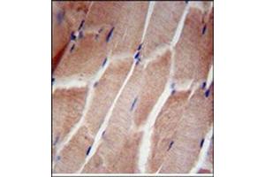 Immunohistochemistry analysis in Formalin Fixed, Paraffin Embedded Human skeletal muscle using RPL5 Antibody (N-term) followed by peroxidase conjugation of the secondary antibody and DAB staining. (RPL5 Antikörper  (N-Term))
