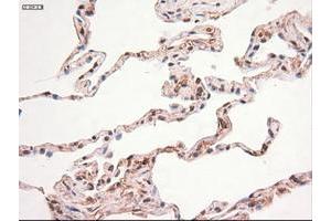 Image no. 4 for anti-Myc Proto-Oncogene protein (MYC) antibody (ABIN1497013) (c-MYC Antikörper)
