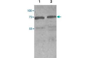 Western blot analysis of HeLa (Lane 1) and MCF-7 (Lane 2) cell lysate with PAK4 polyclonal antibody  at 1 : 250 dilution. (PAK4 Antikörper  (N-Term))