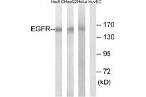 Western Blotting (WB) image for anti-Epidermal Growth Factor Receptor (EGFR) (AA 1036-1085) antibody (ABIN2889086) (EGFR Antikörper  (AA 1036-1085))