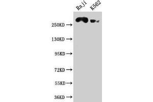 Western Blot Positive WB detected in: Raji whole cell lysate, K562 whole cell lysate All lanes: ATR antibody at 1:2000 Secondary Goat polyclonal to rabbit IgG at 1/50000 dilution Predicted band size: 302, 295, 298 kDa Observed band size: 302 kDa (ATR Antikörper  (AA 2405-2644))