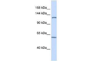 PHF12 antibody used at 0. (PHF12 Antikörper  (C-Term))