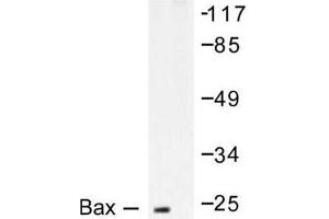 Image no. 2 for anti-BCL2-Associated X Protein (BAX) antibody (ABIN265325) (BAX Antikörper)