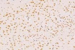 Immunohistochemistry analysis of paraffin-embedded rat tsubstantia nigra using SUN2 (ABIN7075502) at dilution of 1: 4000 (SUN2 Antikörper)