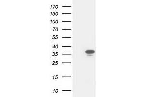 Western Blotting (WB) image for anti-Cyclin-Dependent Kinase 2 (CDK2) antibody (ABIN1497397) (CDK2 Antikörper)