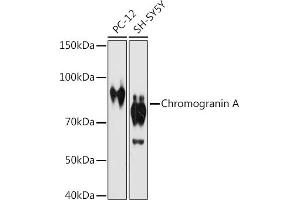 Western blot analysis of extracts of various cell lines, using Chromogranin A antibody (ABIN7266366) at 1:1000 dilution. (Chromogranin A Antikörper)