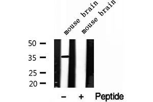 Western blot analysis of extracts of mouse brain tissue, using LDHB antibody. (LDHB Antikörper  (N-Term))