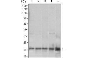 Western blot analysis using MRPL42 mouse mAb against HL7702 (1), SMMC-7721 (2), HEK293 (3) , HeLa (4) and Raji (5) cell lysate. (MRPL42 Antikörper  (AA 10-142))