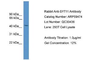 WB Suggested Anti-SYT11  Antibody Titration: 0. (SYT11 Antikörper  (N-Term))