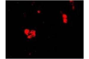 Immunocytochemistry of CIDE-B in Human Small Intestine cells with CIDE-B antibody at 20 ug/ml (CIDEB Antikörper  (C-Term))