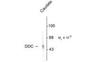 Image no. 1 for anti-Dopa Decarboxylase (Aromatic L-Amino Acid Decarboxylase) (DDC) antibody (ABIN220954) (DDC Antikörper)