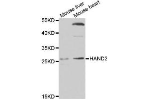 Western blot analysis of extracts of mouse liver and mouse heart cell lines, using HAND2 antibody.