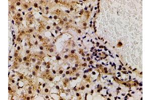 Immunohistochemistry (IHC) image for anti-LIM Domain Kinase 1 (LIMK1) (pThr508) antibody (ABIN6255701)