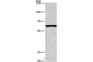 Western blot analysis of Mouse testis tissue, using ARMCX2 Polyclonal Antibody at dilution of 1:425 (ARMCX2 Antikörper)