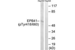 Western blot analysis of extracts from HepG2 cells treated with PMA 125ng/ml 30', using EPB41 (Phospho-Tyr660/418) Antibody. (EPB41 Antikörper  (pTyr660))
