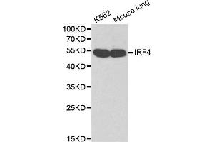 Western blot analysis of K562 cell lines and mouse lung using IRF4 antibody. (IRF4 Antikörper)