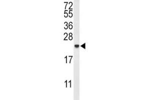 Western blot analysis of IL-10 antibody and MDA-MB435 lysate.