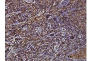 Image no. 1 for anti-Sorting Nexin 1 (SNX1) (AA 166-276) antibody (ABIN598935) (Sorting Nexin 1 Antikörper  (AA 166-276))