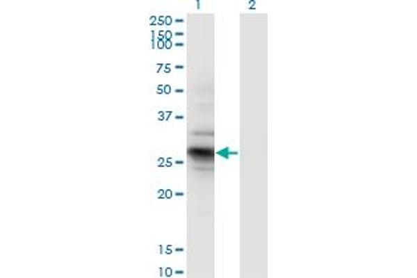 IPP Isomerase 2 Antikörper  (AA 1-227)