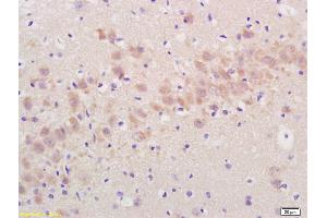 Formalin-fixed and paraffin embedded rat brain labeled with Rabbit Anti Annexin A13 Polyclonal Antibody, Unconjugated (ABIN724250) at 1:200 followed by conjugation to the secondary antibody and DAB staining