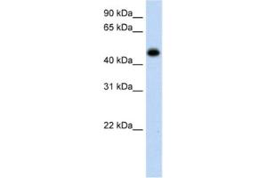 Western Blotting (WB) image for anti-Hydroxyacid Oxidase (Glycolate Oxidase) 1 (HAO1) antibody (ABIN2462589)