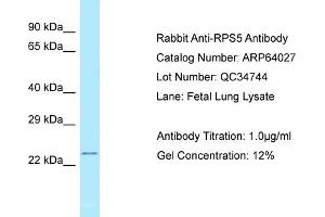 Western Blotting (WB) image for anti-Ribosomal Protein S5 (RPS5) (C-Term) antibody (ABIN2789702) (RPS5 Antikörper  (C-Term))