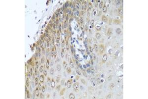 Immunohistochemistry of paraffin-embedded human esophagus using CYPOR antibody (ABIN6130227, ABIN6145969, ABIN6145970 and ABIN7101824) at dilution of 1:100 (40x lens). (POR Antikörper  (AA 1-250))