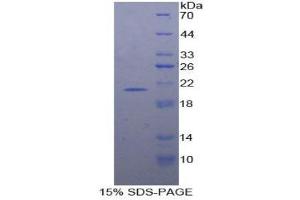 SDS-PAGE (SDS) image for Interferon, alpha 7 (IFNa7) (AA 24-189) protein (His tag) (ABIN1877541)