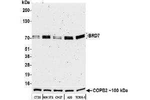 Western Blotting (WB) image for anti-Bromodomain Containing 7 (BRD7) (AA 150-200) antibody (ABIN7449350) (Rekombinanter BRD7 Antikörper  (AA 150-200))